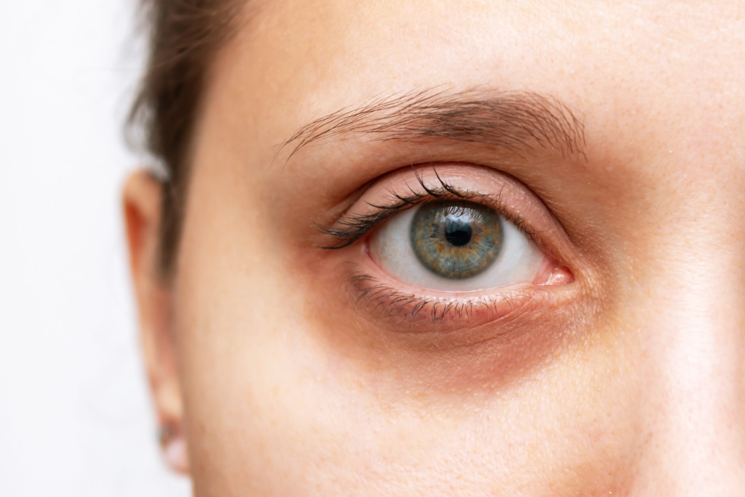 Cropped shot of a young woman's face with dark circle under eye isolated on a white background